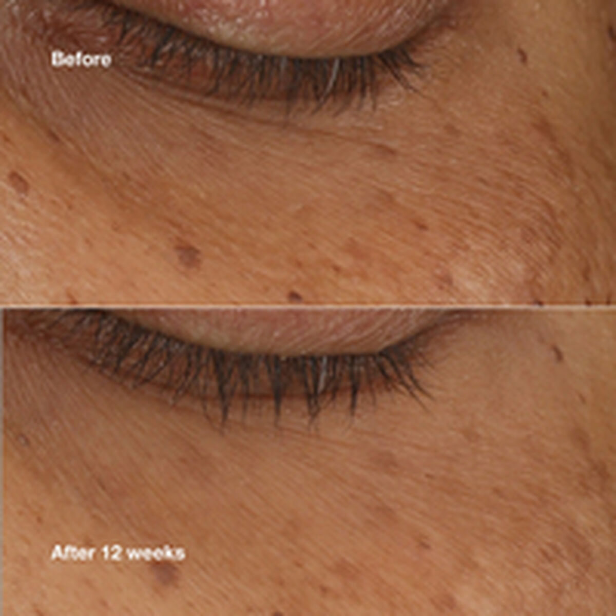 Verzachtend Serum Clinique ALL ABOUT EYES 10 ml