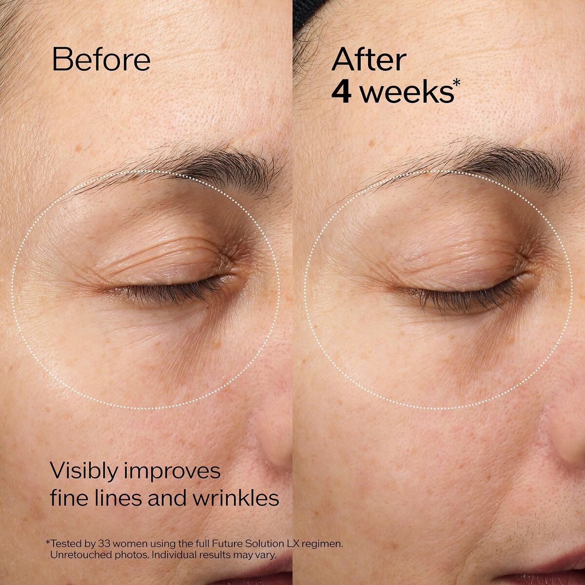 Lippenbalsem Shiseido FUTURE SOLUTION LX 17 ml