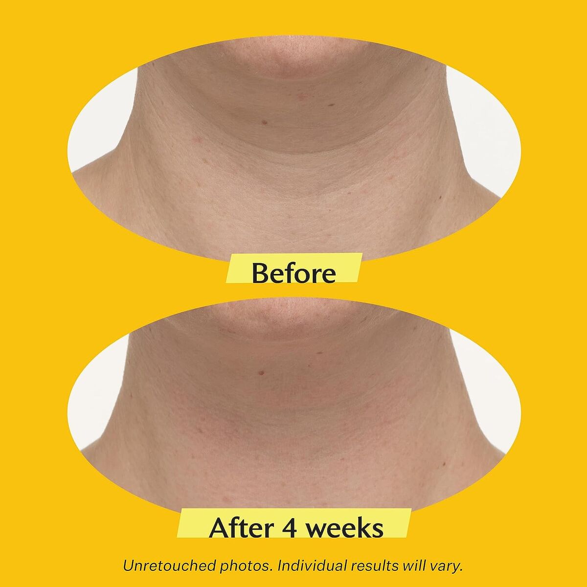 StriVectin TL Advanced Tightening Gezichtscrème - Anti - Aging 50 ml - Schoonheid, Huidverzorging - StriVectin