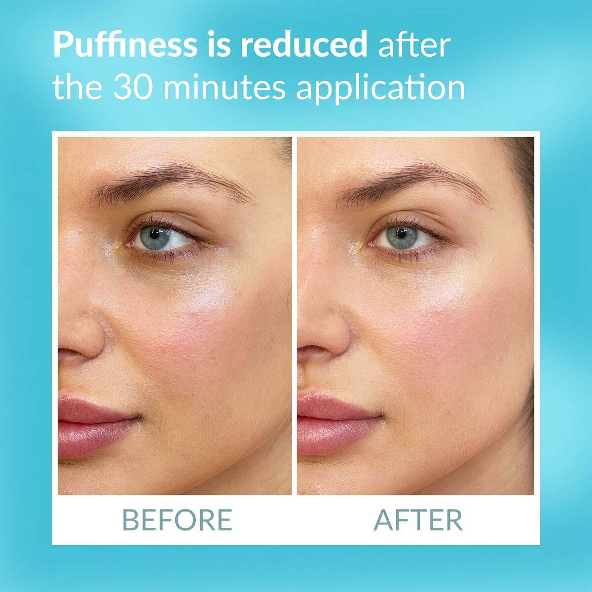 Patchmaskers Talika 10009838 6 Onderdelen