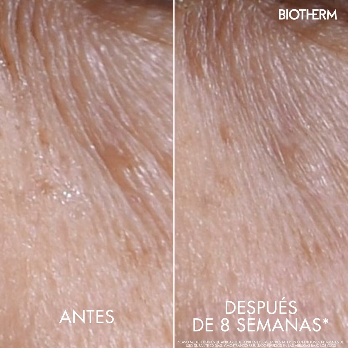 Oogcontour Biotherm BLUE PEPTIDES 15 ml - Schoonheid, Huidverzorging - Biotherm