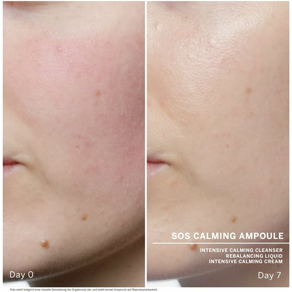 Gelaatsbehandeling Babor Sos Calming