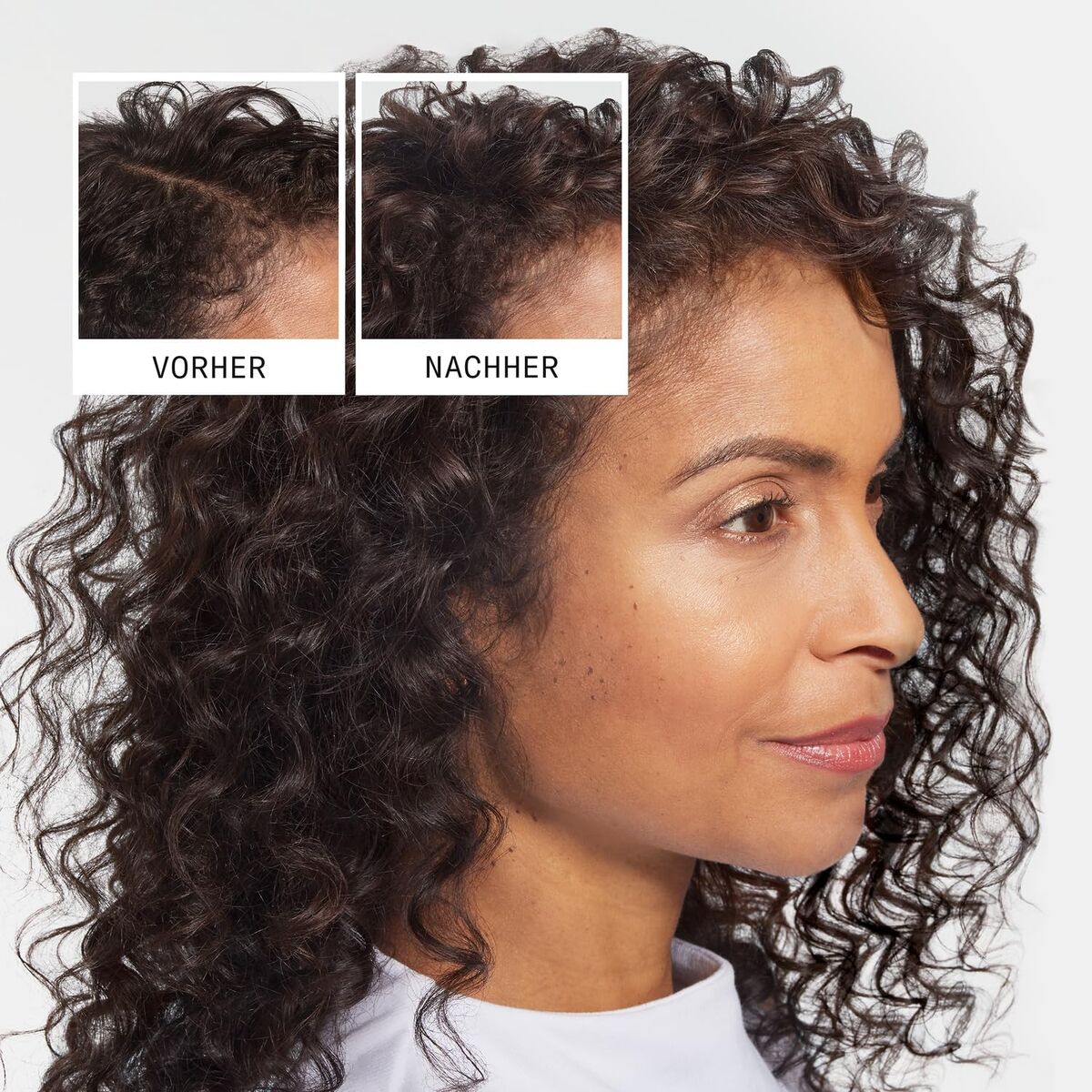 Anti-Haarverlies Shampoo Nioxin Anti-Hairloss 240 ml