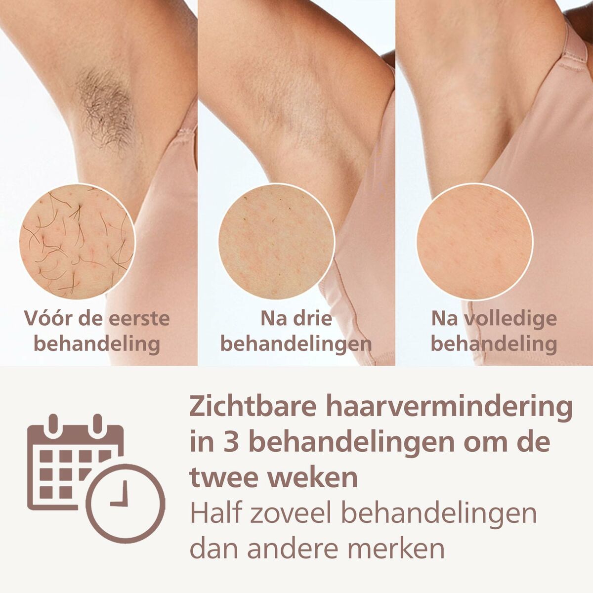 Elektrische IPL Hair Remover Philips BRI946/00 *