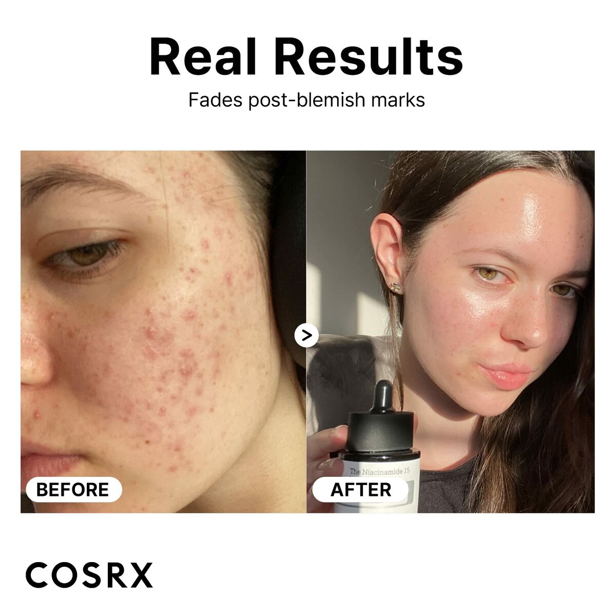 Gezichtscrème Cosrx THE NIACINAMIDE 20 ml - Schoonheid, Huidverzorging - Cosrx