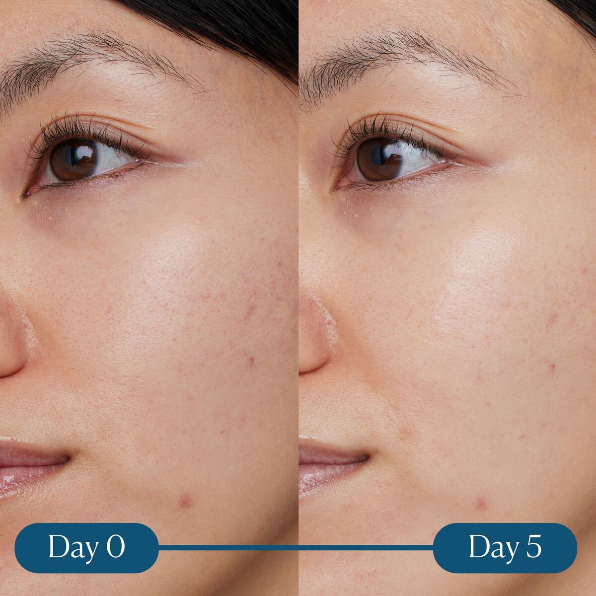 Gezichtsserum Elemis Dynamic Resurfacing 30 ml - Schoonheid, Huidverzorging - Elemis