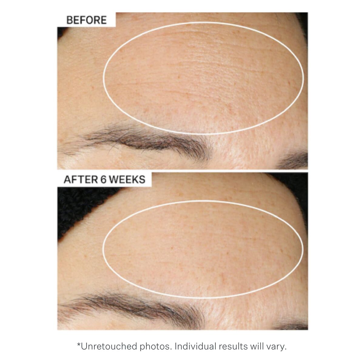 Gezichtsolie StriVectin Multi - Action Versterkende Behandeling (30 ml) - Schoonheid, Huidverzorging - StriVectin