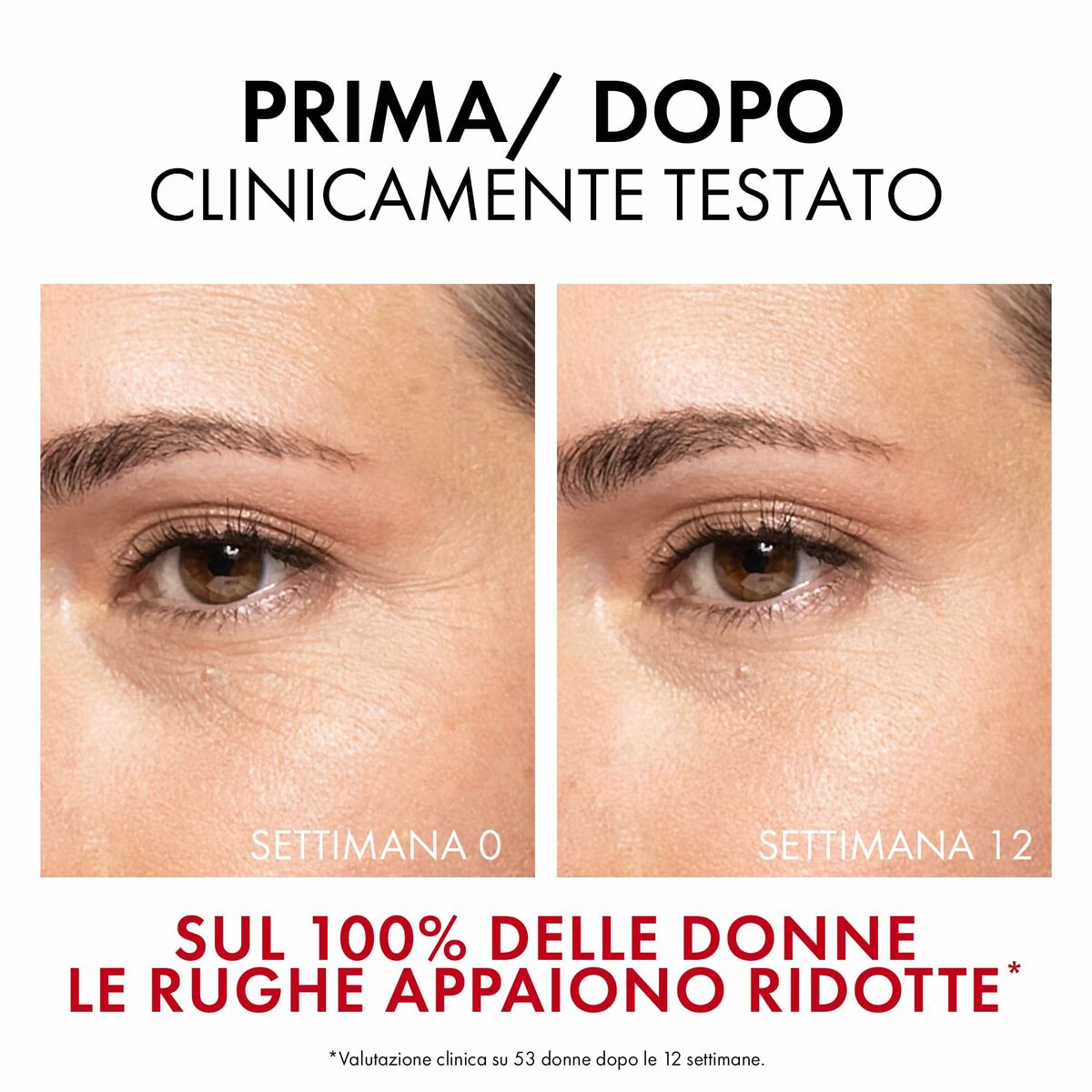 Gezichtsserum Vichy LIFTACTIV 30 ml