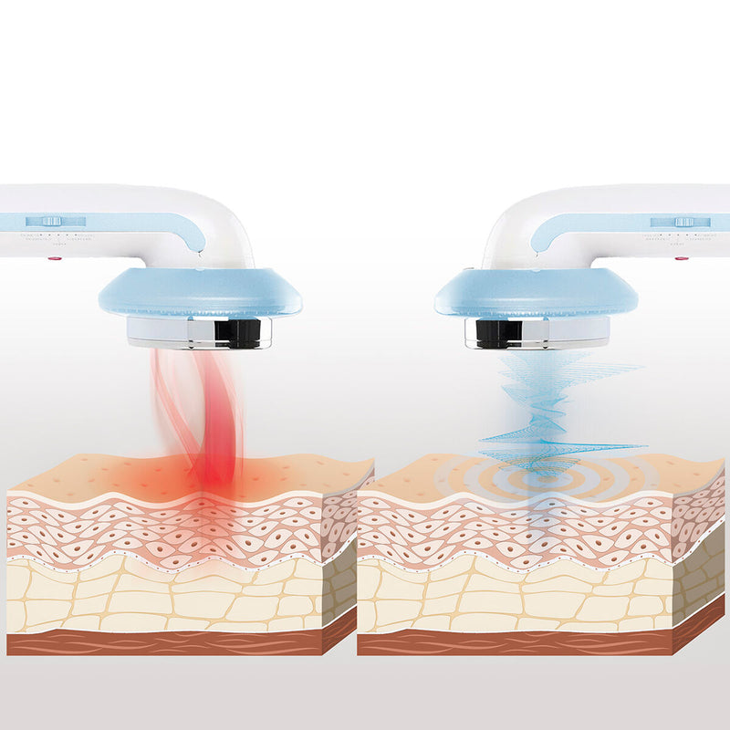 3-in-1 ultrasone cavitatie anti-cellulitisstimulator met infrarood en elektrostimulatie CellyMax InnovaGoods